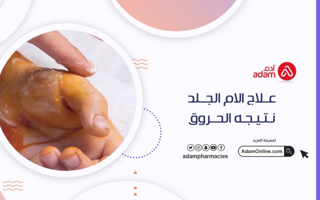 Treatment of skin pain as a result of burns